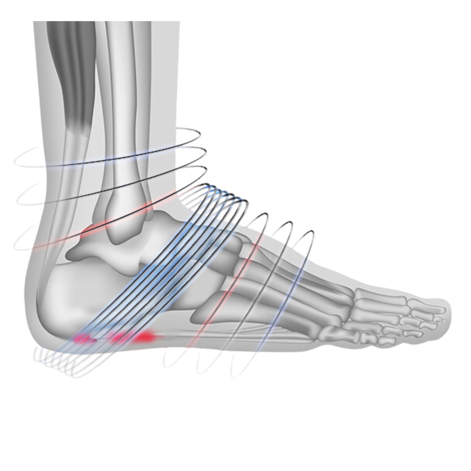 Kit for heel spur with compression socks & heel cup