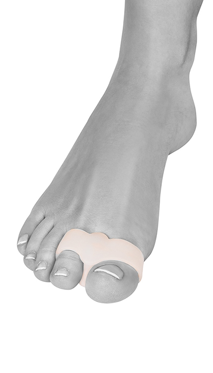 Varpaiden levittimet