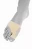 Hallux valgus side Hallux